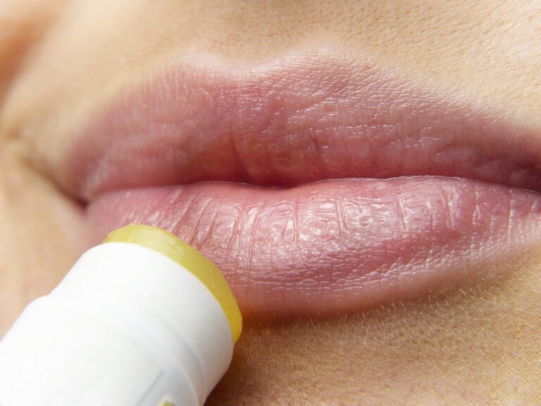 Is Chapstick Gluten Free? Info, Brands and DIY Recipe